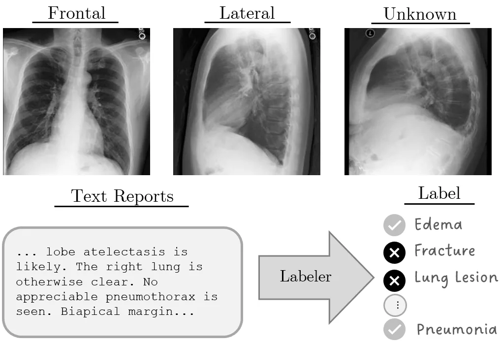نمونه پرونده تصویربرداری در MIMIC-CXR شامل نمای روبرو، جانبی و نامشخص به همراه گزارش رادیولوژی